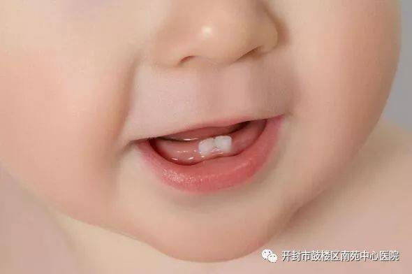 新生儿长牙