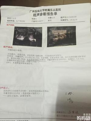 怀孕多久可见孕囊