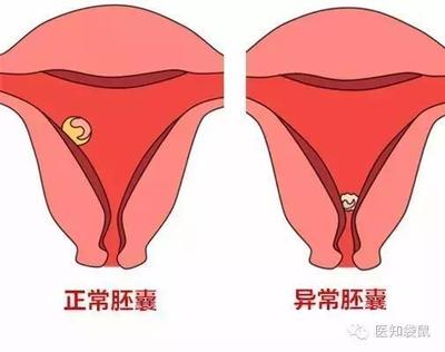 孕几周胎儿才上升腹部