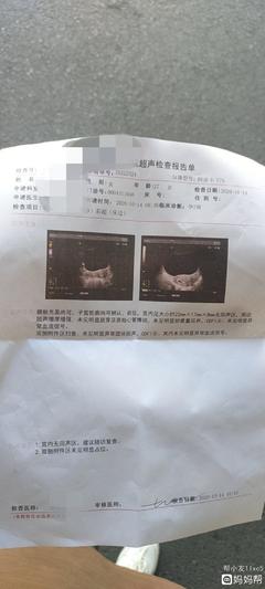 怎么确定是不是怀孕了