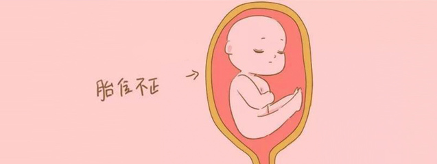 怀孕多久定胎位