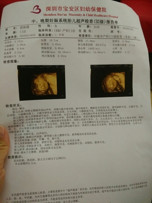 怀孕后要做什么检查