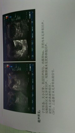 无优势卵泡竟然怀孕了