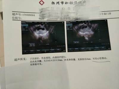 怀孕前会出血吗