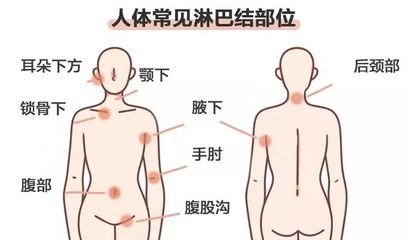 腋下淋巴肿大是怎么回事