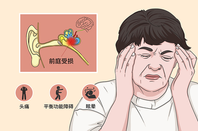 前庭功能眩晕怎么治疗