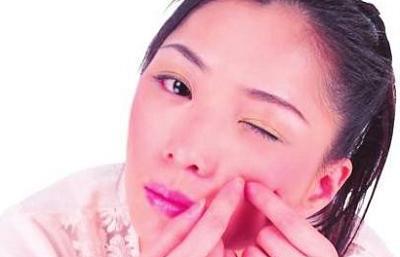 长痘痘可以挤吗