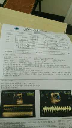 38周吸氧对胎儿好吗