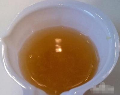 小便混沌是怎么回事