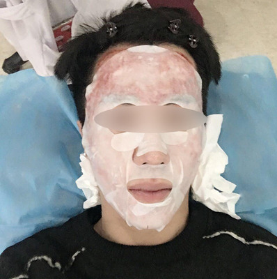 梧州做鼻子华美显著
