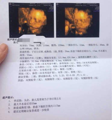 怀孕六个月做四维晚吗
