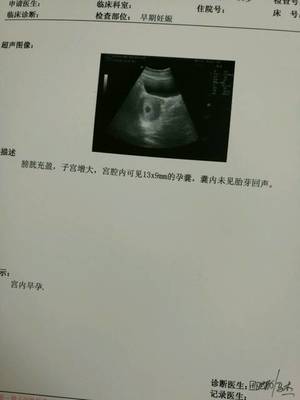 怀孕四十天彩超图片