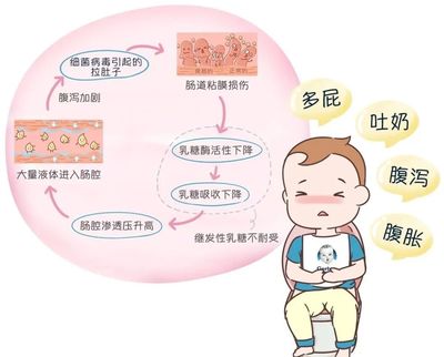 宝宝便秘的原因有哪些