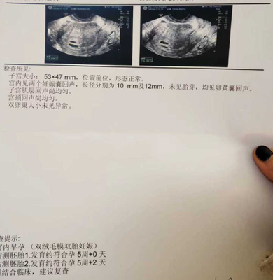 还没着床能测出怀孕吗