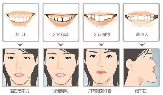 深覆合会怎样影响脸型