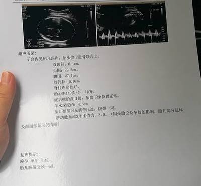 怀孕心率多少算正常