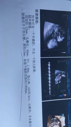 怀孕初期心率多少正常