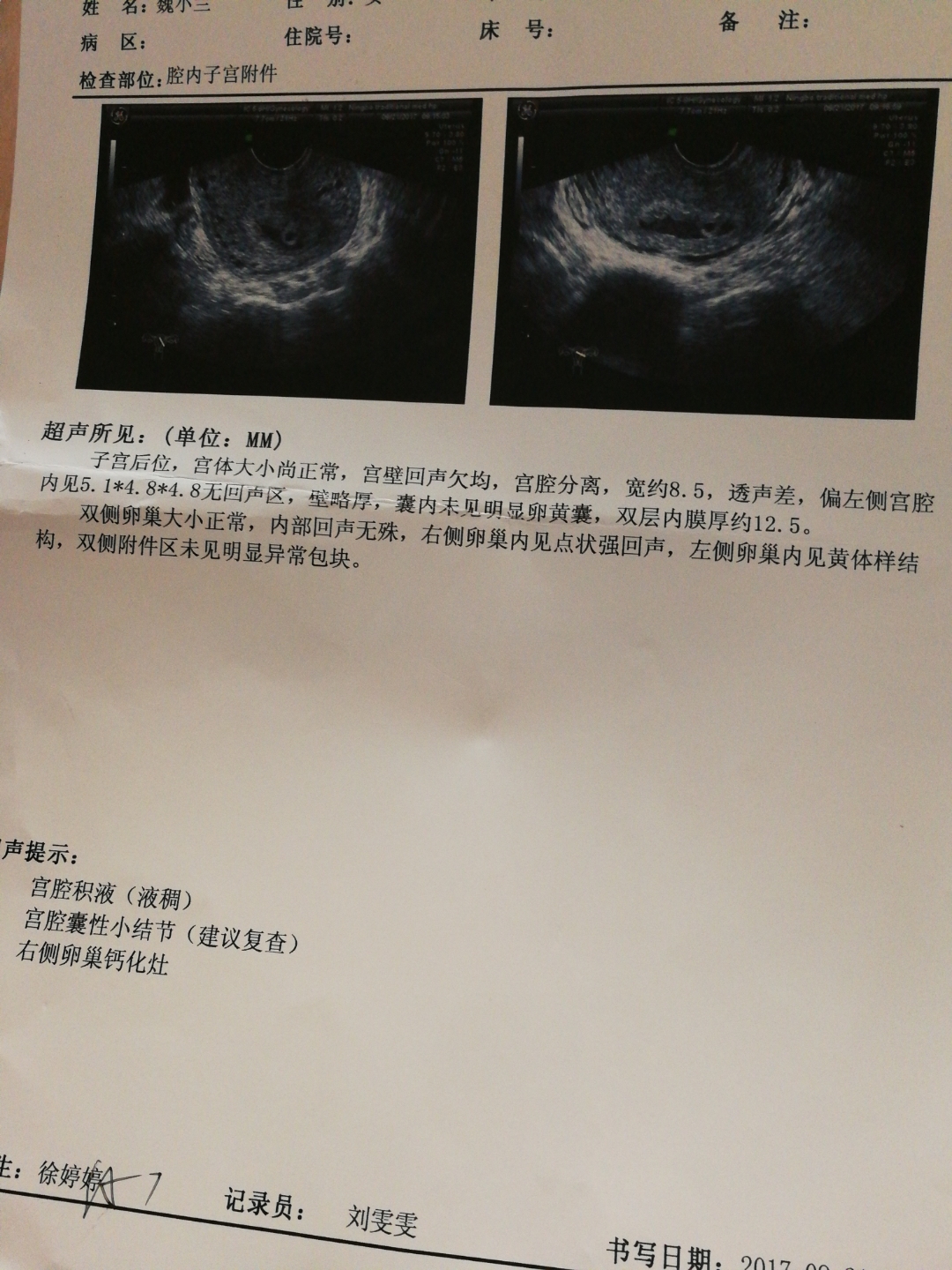 怀孕35天能看到孕囊吗