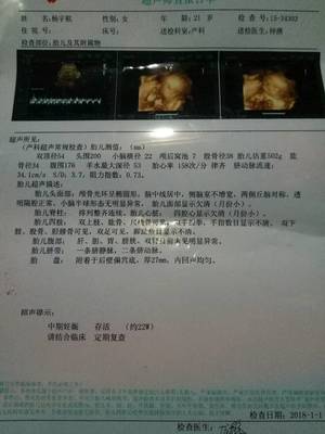 孕妇需要做心脏彩超吗