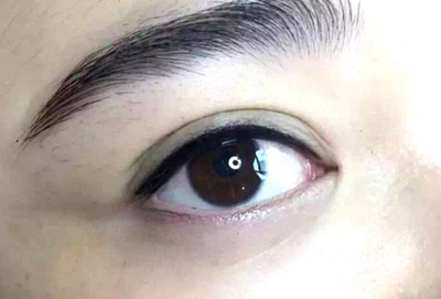 眼睛疼又肿是怎么回事