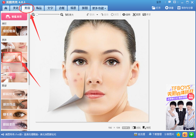 照片中的痘痘去掉吗