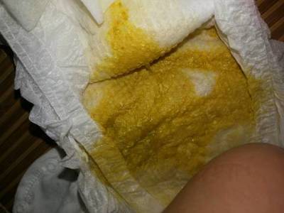 宝宝的便便有酸臭味