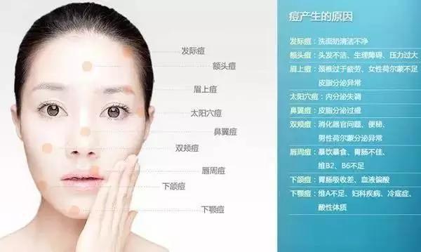 痘痘男護膚哪個好