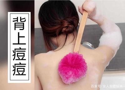 背上痘痘怎么祛除