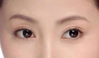 双眼皮怎么修复