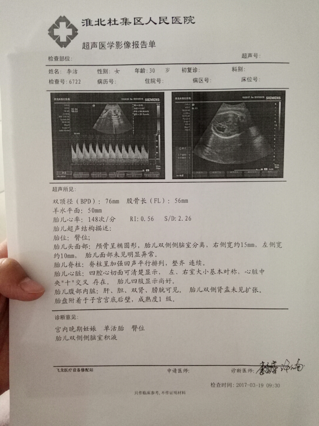 引产胎儿是活的吗