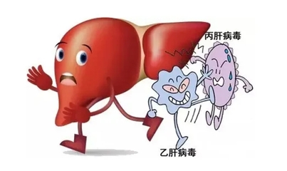 丙型肝炎是怎么回事