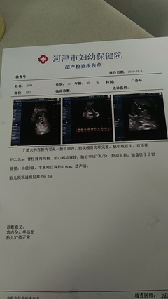 12周胎儿nt值正常范围
