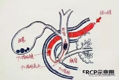 肝胆脾肾全面检查要多少钱