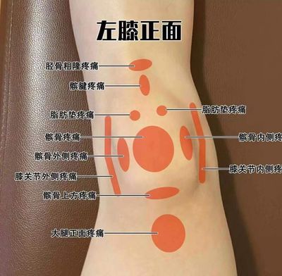 髌骨疼痛怎么治疗