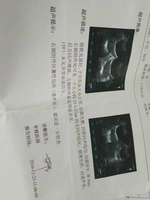 巧克力囊肿手术后多久可以怀孕