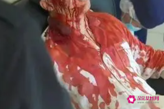 怀孕老是梦见死人