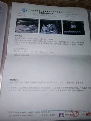 怀孕检查什么项目