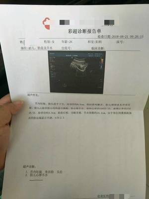 胎儿心律不齐后来好了