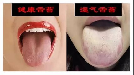舌苔没了是怎么回事
