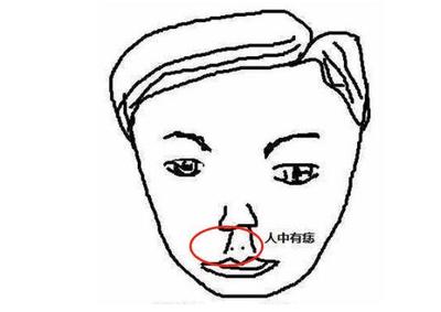 人中歪斜的面相