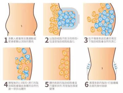 抽脂融脂