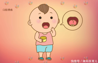 宝宝上火口腔溃疡怎么办