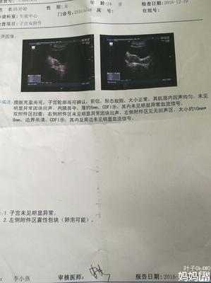 卵巢包块是怎么回事