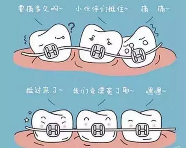 矫正牙齿的利与弊