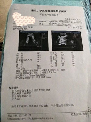多少周估算胎儿体重