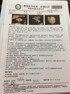怀孕4个多月胎动频繁正常吗