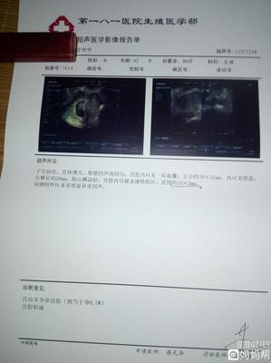 怀孕为什么会宫腔积液