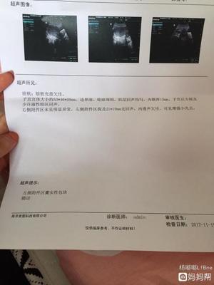 巧克力囊肿手术后多久可以怀孕