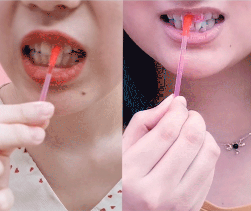 牙齿有菌班