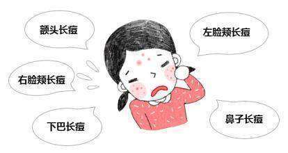 右脸颊为什么会长痘痘